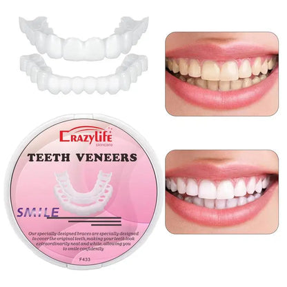 1 Set Teeth Veneers Tooth Cover Dentures Dental Veneers SnapOn Cover The Teeth Fake Tooth Instant Confidence Smile Temporary
