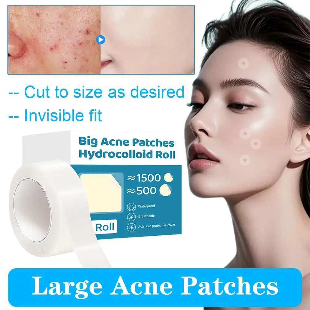 Face Acne Pimple Spot Facial Skin Care Blackhead Removal Freckle Patches Scar Care Treatment Stickers Acne Mask Beauty